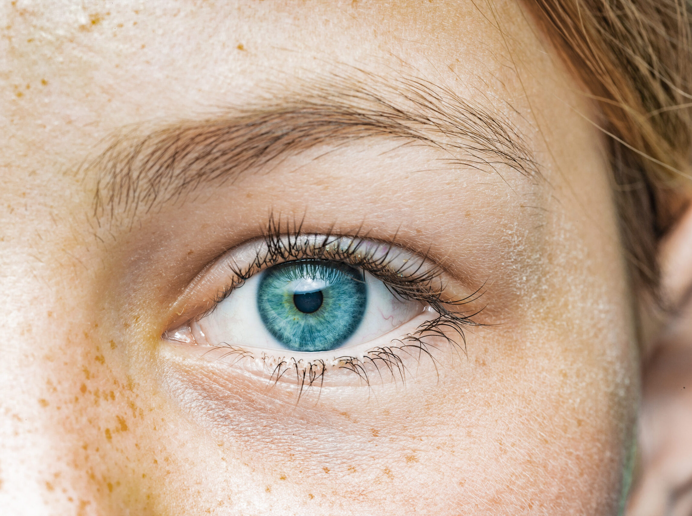 Augenarztpraxis Winti - Dr. med. Murat Yildirim - Marktgasse 78 - Winterthur - Telefon 052 212 26 29